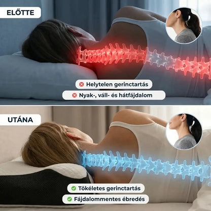 Zevery™ Ergonomikus Párna – Ébredj végre nyakfájdalom nélkül
